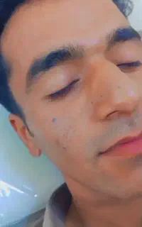 خال ولک وجوش زیر پوستی بدون درد