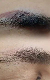 ریمو ابرو شید لب چالوس رادیودریا