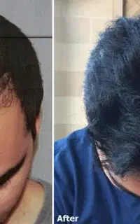 برترین مرکز کاشت در اردبیل