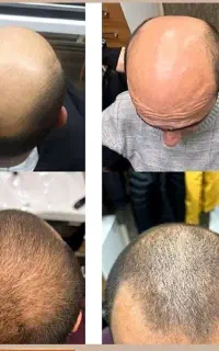 موهای پر پشت ، اعتماد به نفس بیشتر