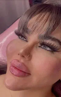 کلینیک جشنواره اقساط ژل بوتاکس مزو آنزیم نخ فیلر