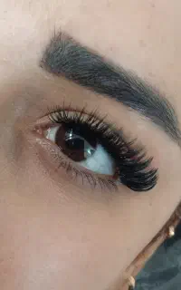 کاشت مژه هیدن