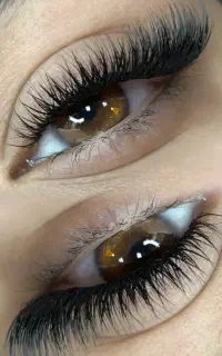 کاشت مژه