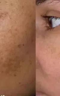 جوان شو ودعام کن(جشنواره ویژه کرم بیوممتیک)