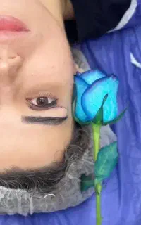 بلفاروپلاستی-سانترال لب-بوکال فت-ساکشن غبغب