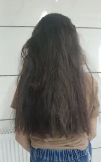 خدمات موخوره گیری تخصصی
