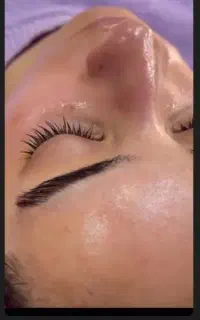 زیبایی صورت...تخفیف واقعا استثنایی
