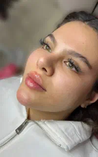 تخفیف به مدت ۳روز تزریق ژل/ بوتاکس/فیلر/مزوتراپی