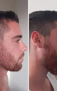 بازی در نیار ریش بذار زیاد