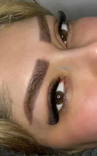 کاشت هیدن۳۵۰ تومن .خریدار مو سر۷۰تا۱۳۰میلیون