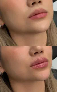 مطب پوست زیبایی لاغری