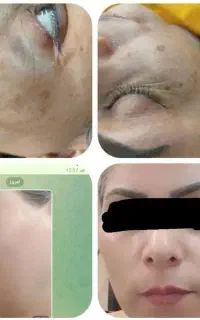 برطرف کردن تمام مشکلات پوستی