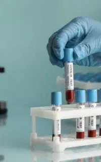 ثبت نام(مهلت آخر)آموزش پرسنل آزمایشگاه در سنندج