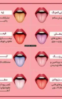 بادکش ماساژ