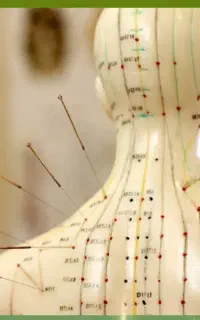 آموزش طب سوزنی در اصفهان/ماساژ درمانی کاربردی/مدرک
