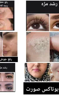 اکسیر جوانی
