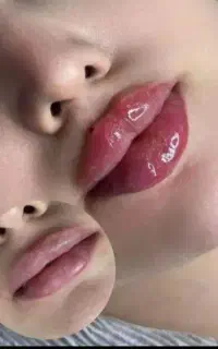 خدمات فیلرتخصصی  برند اصل ماندگار آف ۵۰ درصد3 روزه