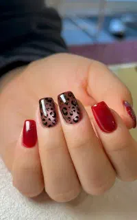 کاشت ناخن ۳۰۰