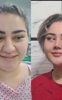 جراحی زیبایی بینی دکتر سیدجلال سیدقیاسی تبریز