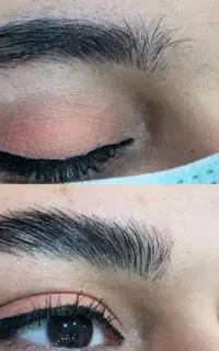 اصلاح صورت و ابرو