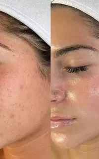 تخصصی فشیال فقط بانوان)