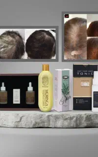 تونیک هیدرولیزی بیوژن ،اکسونیک و لوشن