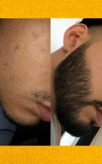 مثل فرش پر تراکم میشه