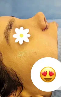 جراحی زیبایی