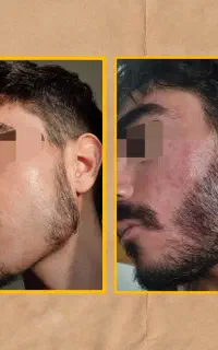 قبل خاستگاری پر پشتش کن