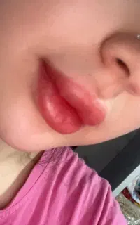 فیبروز و شیدینگ