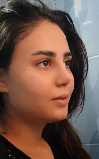 انتخاب فرم بینی متناسب با چهره