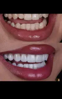 کلینیک لبخند زیبایی