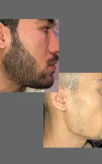 ریش و باش