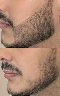 ریشاتو جذاب کن