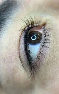 نیازمند مدل میکروبلیدینگ فیبروز و بن مژه