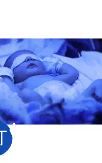 اجاره دستگاه زردی نوزاد(فتوتراپی)