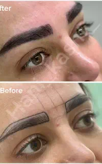 جشنواره کاشت ابرو به مدت محدود و قیمت باورنکردنی