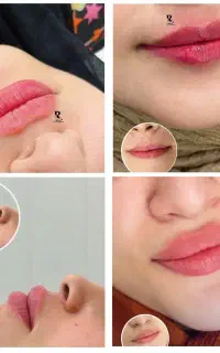 فیلر و بوتاکس کلینیک بهتا