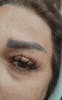 کاشت مژه 300هزار
