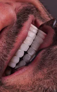 خدمات دندانپزشکی با شرایط اقساطی