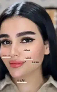 تزریق ژل و بوتاکس