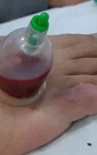 ماساژ وطب سنتی