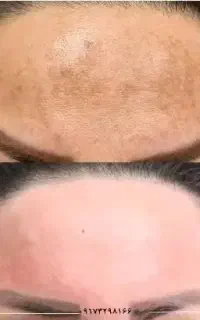 کرم روز و شب لاکچری کوین مناسب انواع پوست