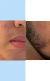 بازی در نیار ریش بذار زیاد