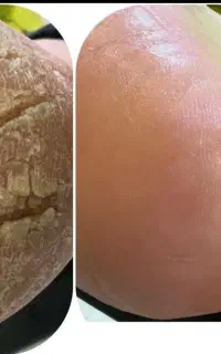 خدمات اسپا/پدیکور‌کف‌سابی/‌پارافین‌تراپی