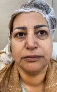 مدل پاکسازی پوست و نوردرمانی