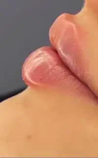 آموزش تخصصی فیلر و بوتاکس از مبتدی تا حرفه ای