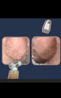 بیا خودت از بی ریشی بی مویی نجات بده.