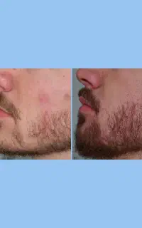 پسرا حق ندارن ببینن