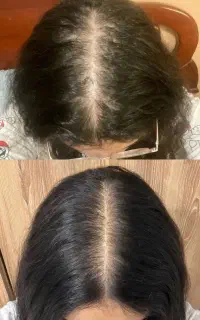 یک تار نازک یک علامت مهم
